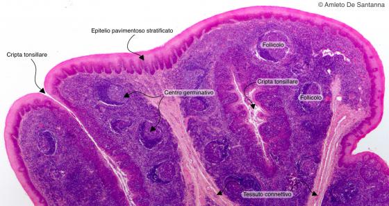 Figura C131A. Tonsilla palatina umana
