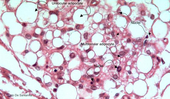 Figure C48. Adipose tissue of a marmot