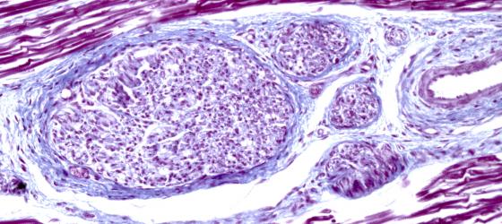 Figura C11. Tessuto muscolare umano