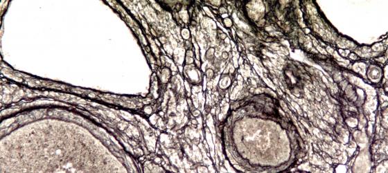 Figura C14. Ovario di topo a più forte ingrandimento