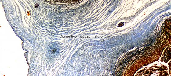 Figura C2. Funicolo ombelicale umano