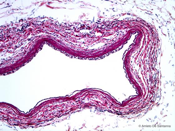 Figura C26. Arteria umana