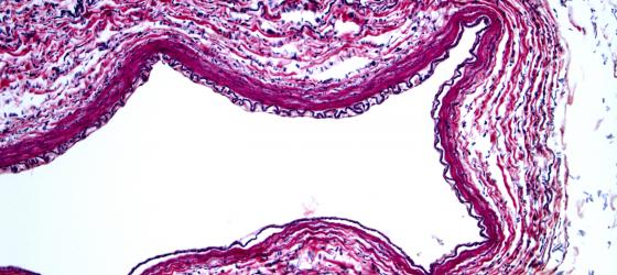 Figura C26. Arteria umana