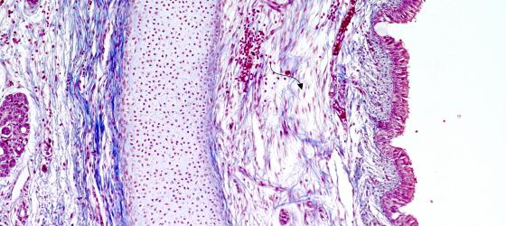 Figura C6. Trachea fetale umana