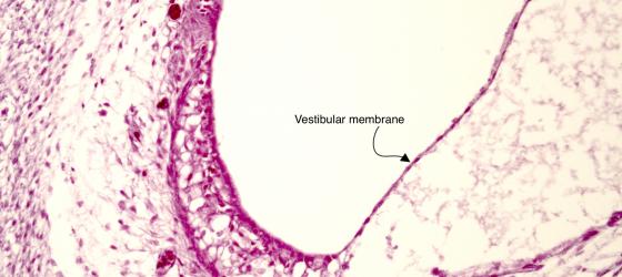 Figure E12. Human fetal internal ear