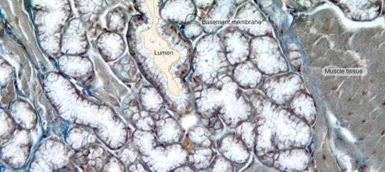 Figure E120. Human sublingual gland at higher magnification