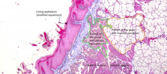 Figure E125A. Human fetal tongue