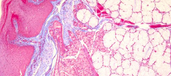 Figure E126. Human fetal tongue at higher magnification