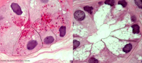 Figura E134. Montaggio di due micrografie