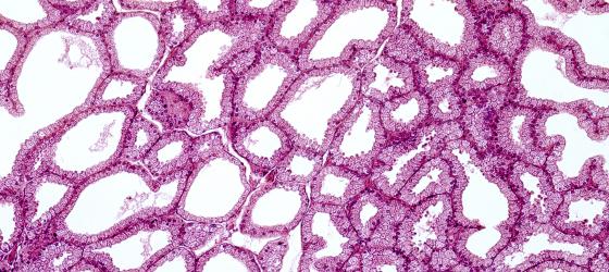 Figura E151. Ghiandola lacrimale umana a più forte ingrandimento