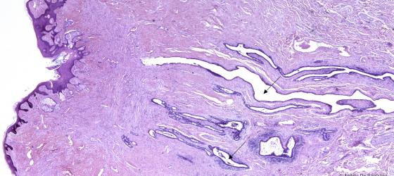 Figura E157. Mammella umana