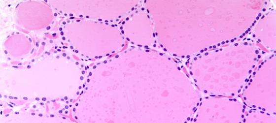 Figura E163. Tiroide umana a più forte ingrandimento