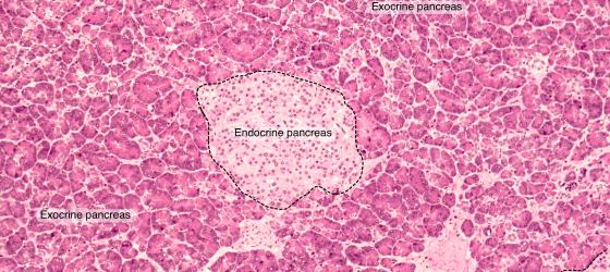 Figure E170A. Human pancreas