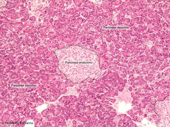 Figura E170A. Pancreas umano