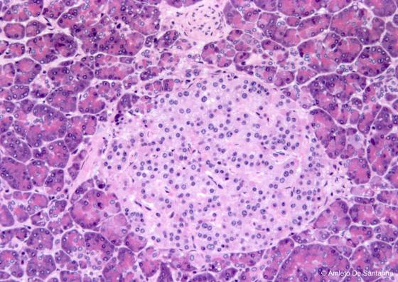 Figura E171. Pancreas umano, isolotto del Langherans