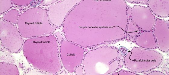 Figure E17A. Human thyroid