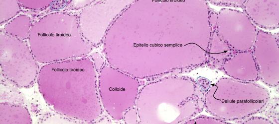 Figura E17A. Tiroide umana