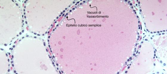 Figura E18. Ghiandola tiroide umana