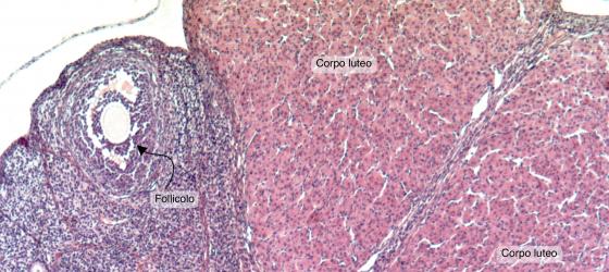 Atlante ed epitome di ginecologia. L epoch e quando la tensione  intra-addomi-nale è aumentata. Sterilità, dalla solita combi-nazione con  ooforite. Febbre (in gonorrea, solo post-sforzo o eccitazione). Prognosi -  la concezione