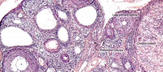 Figure E191. Mouse ovary