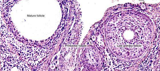 Figure E192. Mouse ovary