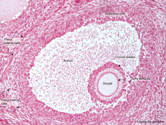 Figure E193A. Human ovary