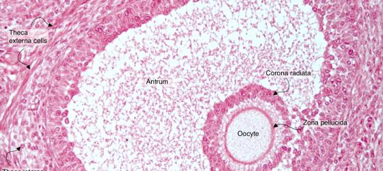 Figure E193A. Human ovary