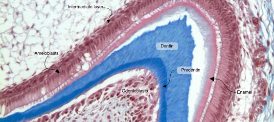 Figure E200. Human fetal tooth bud