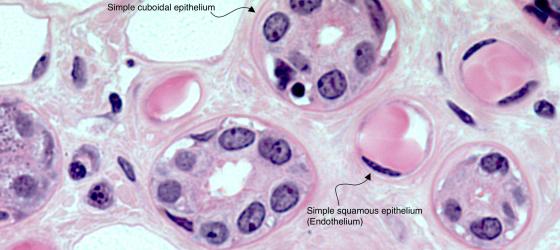 Figure E21. Human parotid gland