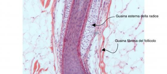 Figura E212. Cuoio capelluto umano