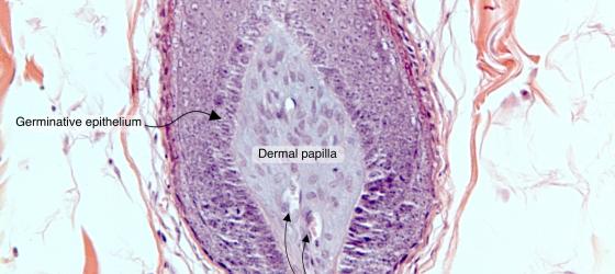 Figure E213. Bulb of a human hair follicle