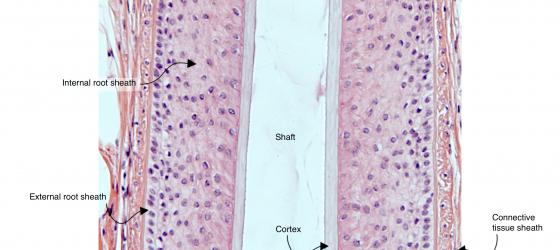 Figure E214. Human scalp