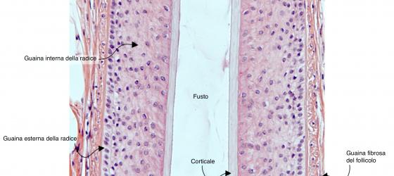 Figura E214. Cuoio capelluto umano