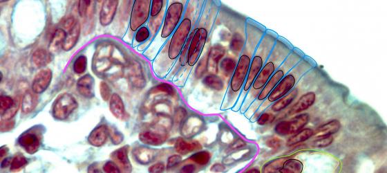 Figure E23. Digitally annotated micrograph of the columnar epithelium