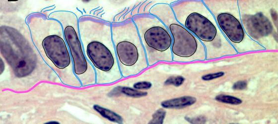 Figure E24. Digitally annotated micrograph of the ciliated columnar epithelium