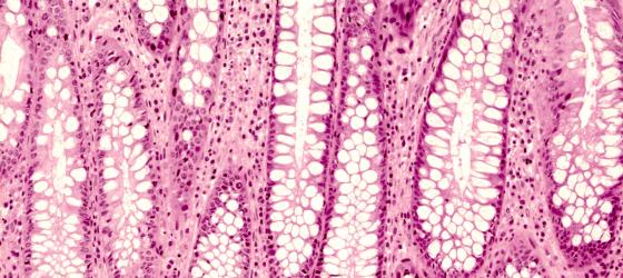 Figura E26. Colon umano a forte ingrandimento