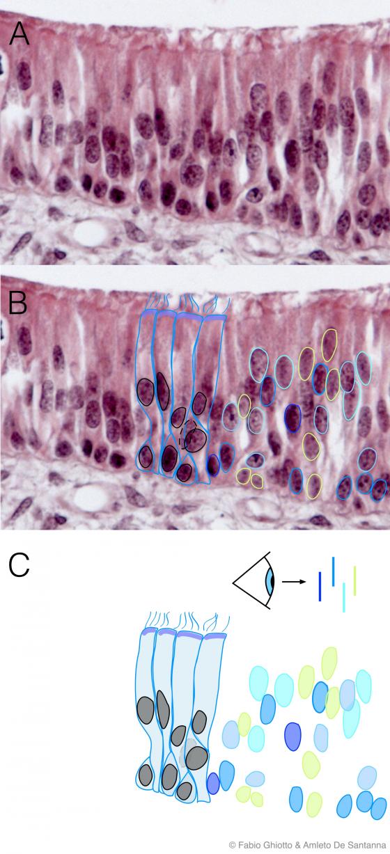 Figura E39. Micrografia di epitelio cilindrico pseudostratificato ciliato annotata digitalmente