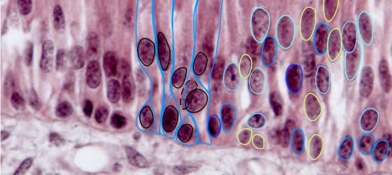 Figura E39. Micrografia di epitelio cilindrico pseudostratificato ciliato annotata digitalmente