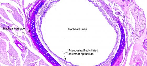 Figure E43. Mouse trachea