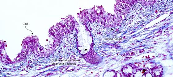 Figura E45. Trachea umana