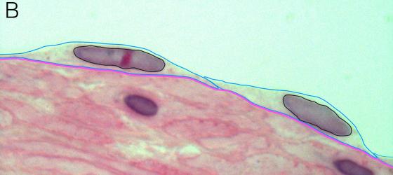 Figure E5. Digitally annotated micrograph of simple squamous epithelium