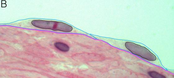 Figura E5. Micrografia di epitelio pavimetoso semplice annotata digitalmente