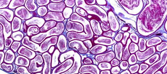 Figura E51. Epididimo di ratto