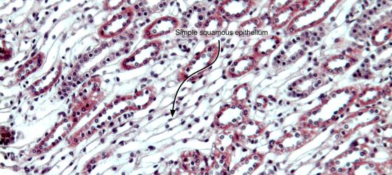 Figure E9. Rabbit kidney