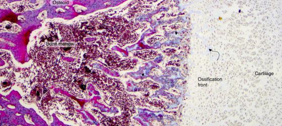 Figure C101. Human fetal foot