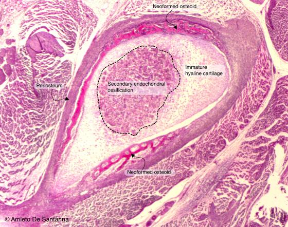 Figure C107. Human fetal femur