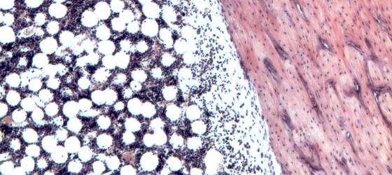 Figure C109. Human bone marrow in situ