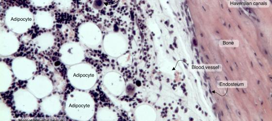 Figure C110A. Human bone marrow in situ at higher magnification