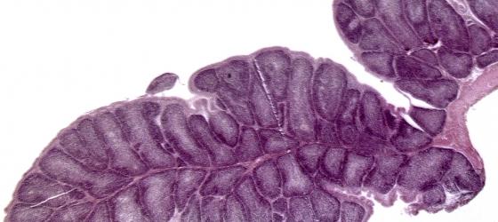 Figura C112. Borsa di Fabrizio, organo linfoide primario presente solo negli uccelli e situato nello spessore della parete intestinale. Ematossilina ferrica-Eo 12,5x