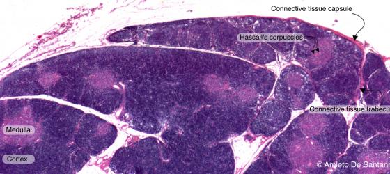 Figure C114A. Human thymus